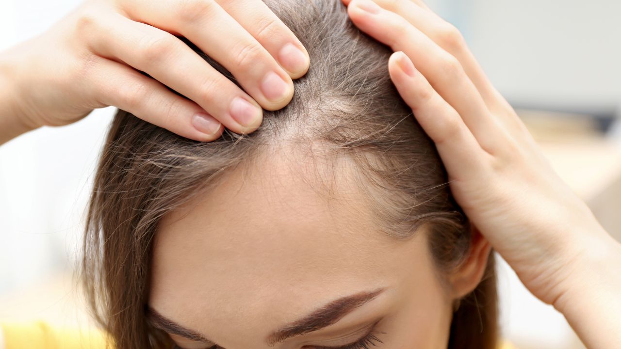 Medspa Aurora Hair Thinning